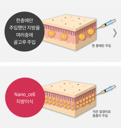 Nano-Cell 지방이식